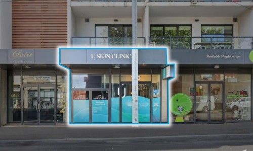 Featured Item Featured Item